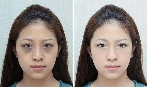 熬夜后皮肤暗沉无光教你4招告别黄脸婆