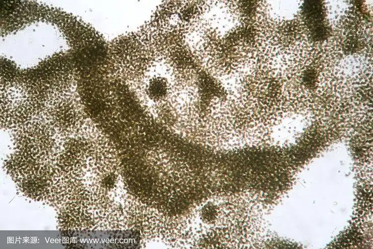 超宏观显微镜.水开花污染的生态问题