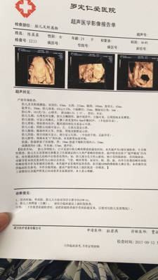 昨天照了四维说唇腭裂好担心,不知道该怎麼办