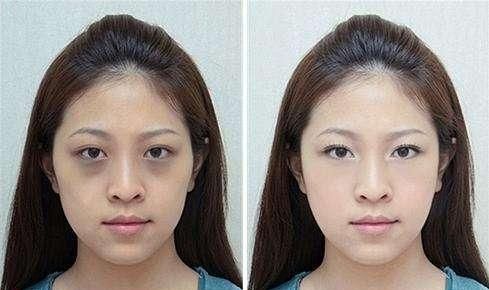 熬夜后皮肤暗沉无光教你4招告别黄脸婆