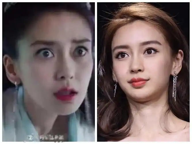 四白眼的问题很好解决,天宝整了眼睛后会戴美瞳达到和谐感,吉娜一直都